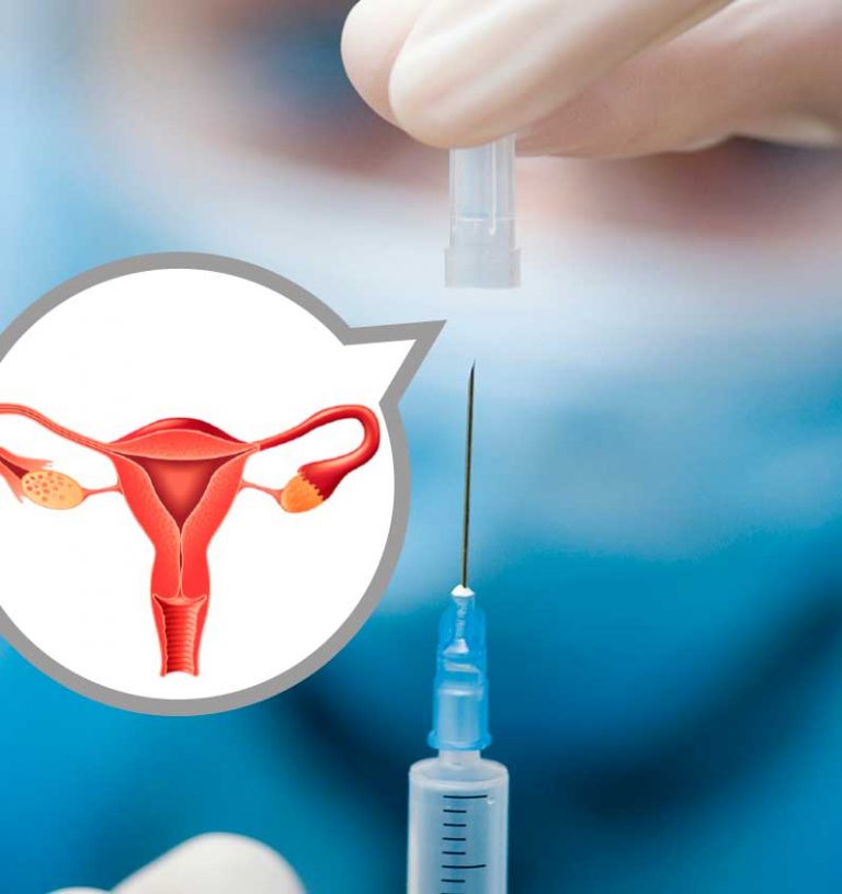 在比利时，每年有190名女性死于宫颈癌！